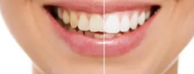 Entreprises 2 image KUNSTGEBIT EN TANDIMPLANTAAT SPECIALIST tandartspraktijken dans Sint-Niklaas VOV